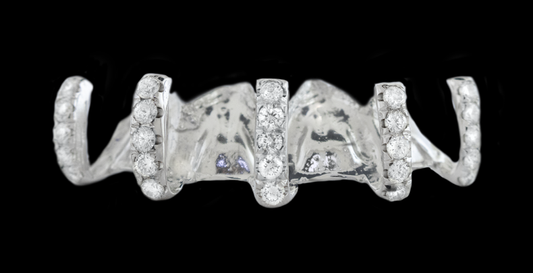 5 Piece Iced Gap Filler Grillz