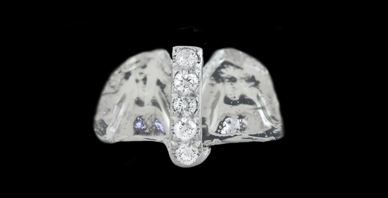 Single Tooth Diamond Filler