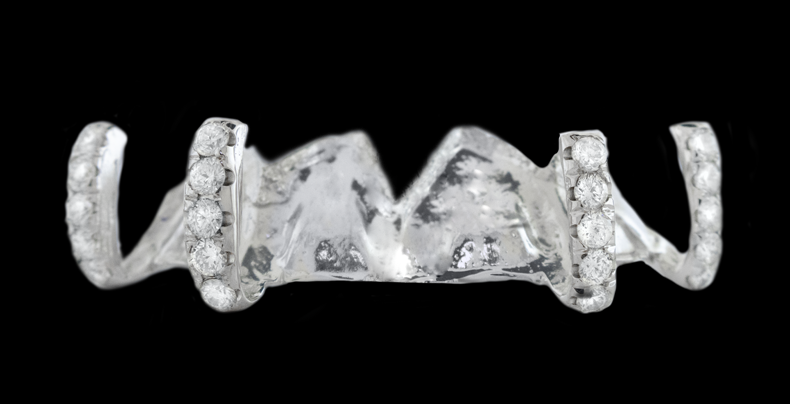 5 Piece Iced Gap Filler Grillz