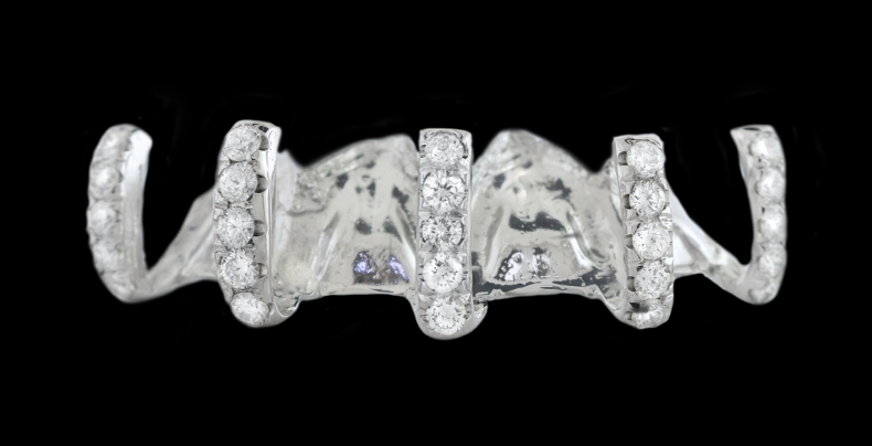5 Piece Iced Gap Filler Grillz