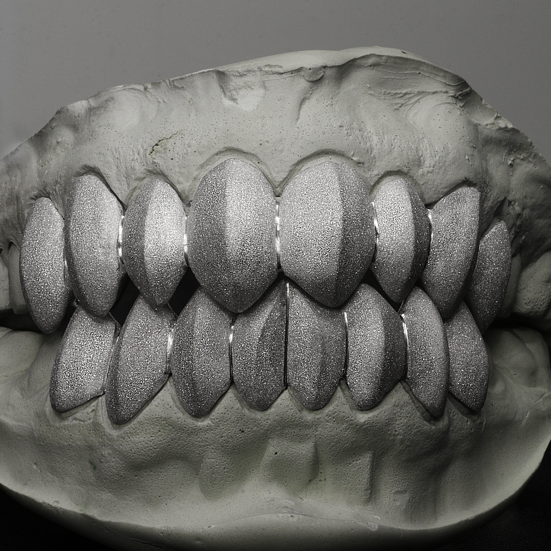 8 Piece Shark Teeth Diamond Dust Grillz SET