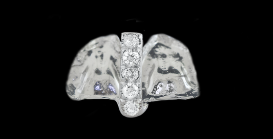 5 Piece Iced Gap Filler Grillz
