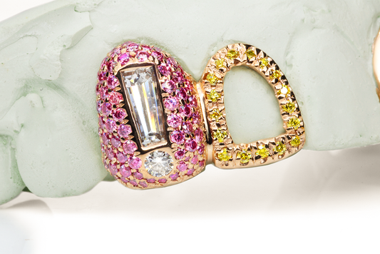 Canary Pink Exclamation Mark Design Grillz