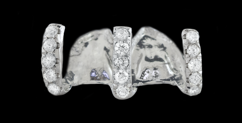 5 Piece Iced Gap Filler Grillz