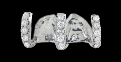 5 Piece Iced Gap Filler Grillz