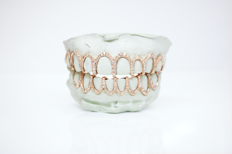 Diamond Horseshoe Grillz SET