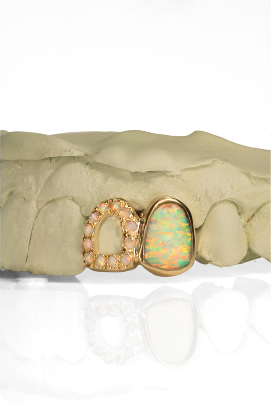 Opal Aura Grillz